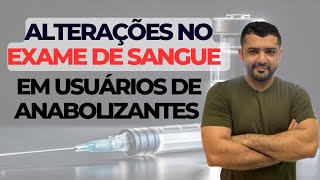 Exame de sangue e anabolizante é isso que pode acontecer [upl. by Rockey]