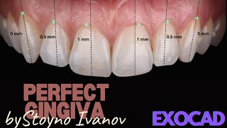 How to Design the Perfect Gingiva in EXOCAD [upl. by Sig636]