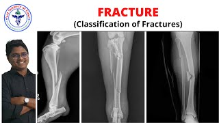 FRACTURE Classification  Lecture 02 I Orthopedics [upl. by Aleak]