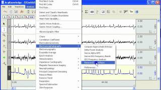 EEG  EOG Artifact Removal [upl. by Reyna671]