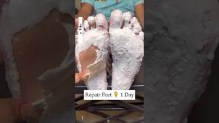 Repair cracked heels in just one daysviralvideo shorts crackedheels [upl. by Ymorej822]