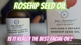 Juicy chemistry Rosehip Seed oil review  Best Facial Oil for oily skin [upl. by Otilegna]