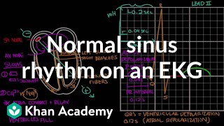 Normal sinus rhythm on an EKG  Circulatory System and Disease  NCLEXRN  Khan Academy [upl. by Lunneta]