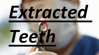 What Can Be Done If Teeth Are Already Extracted by Prof John Mew [upl. by Ytomit384]