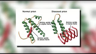 CJD CreutzfeldtJakob Disease  Mayo Clinic [upl. by Hazeghi975]