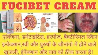 FUCIBET CREAM  हर तरह के स्किन इनफेक्शन और घाव को ठीक करने वाला दावा बैक्टीरियल इनफेक्शन का दावा [upl. by Cornish670]