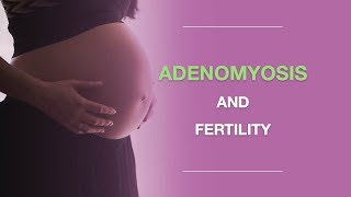 Adenomyosis and Fertility What You Should Know About Adenomyosis And Pregnancy [upl. by Ajnotal]