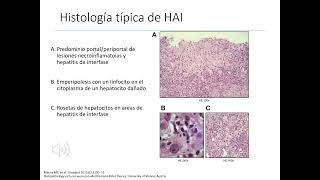 GASTROENTEROLOGÍA 7 Hepatitis crónica [upl. by Nahallac]