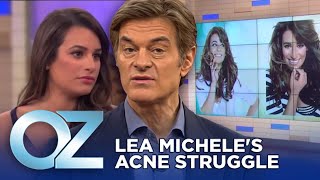 Lea Micheles Acne Struggle  Oz Celebrity [upl. by Abdu]