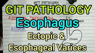 Ectopia amp Esophageal Varices  GIT Pathology [upl. by Alahsal]