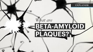 What are BetaAmyloids plaques [upl. by Shakespeare]