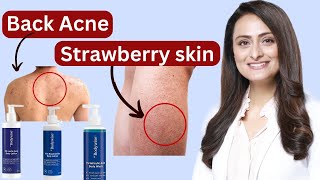 My Verdict on the Be Bodywise Bodycare Range for Back Acne amp Strawberry Legs [upl. by Nomihs]