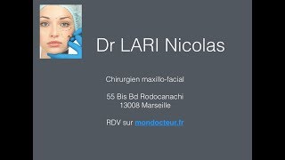 lifting sans chirurgie par ultherapy dr lari nicolas [upl. by Zetrok370]