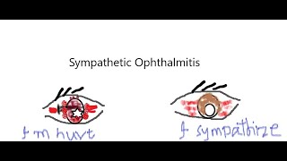 SYMPATHETIC OPHTHALMITIS KanskiSeries 2022 [upl. by Bork]