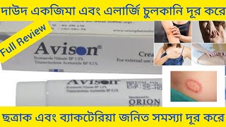 Avison Cream দাউদ একজিমা এবং চুলকানি ভালো করার ঔষধ সম্পর্কে বিস্তারিত আলোচনা [upl. by Maitland]