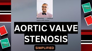 AORTIC VALVE STENOSIS [upl. by Ased]