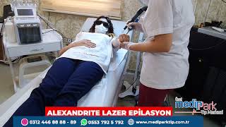 Alexandrite Lazer Epilasyon İşlemi Nedir Nasıl Uygulanmaktadır ❤️lazerepilasyonalexandritelazer [upl. by Atilem167]