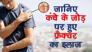 Proximal Humerus fracture treatment I कंधे के जोड़ के फ्रैक्चर का इलाज [upl. by Okir]