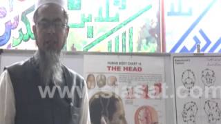 Hijama Benefits for Head part 2 [upl. by Htehpaj]