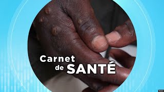 Carnet de Santé  La variole du singe [upl. by Niamjneb]