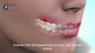 TUTORIAL TAGLIARE FILO APPARECCHIO FISSO [upl. by Einnaffit]