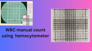 WBC manual count using hemocytometer [upl. by Ocihc]