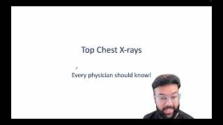 Top 8 Essential Chest XRay Findings Every Physician Should Know  Radiology Basics  USMLEStrike [upl. by Althea]