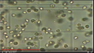 How to count Rbcs amp Wbcs content using Hemocytometer [upl. by Canica]