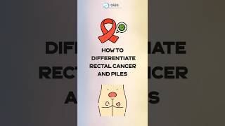 How to differentiate Rectum Cancer and Piles  Dr Aditya Kulkarni dradityakulkarni oasisclinic [upl. by Trumann]