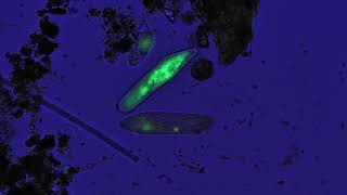 Freshwater ciliates stained acridine orange [upl. by Rozalin213]