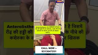 Anterolisthesis  Chiropractic Treatment in Delhi  Dr Varun  Call  9313047251 delhi noida [upl. by Pestana]