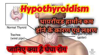 Hypothyroidism causes symptoms diagnosis amp treatment in hindi [upl. by Damaris]