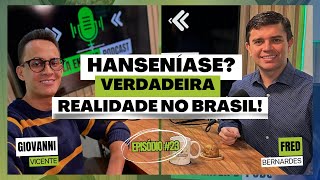 Hanseníase Como esta a realidade no Brasil  com Fred Bernardes  Episódio 023 [upl. by Maggy]