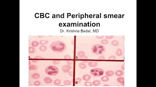 CBC and peripheral smear [upl. by Arjan]