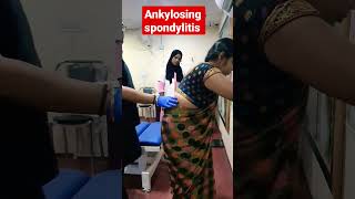 Ankylosing spondylitis treatment 93085113578409313131 drrajneeshkant [upl. by Ydoj]