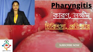 Pharyngitis In Bangla  Causes  Treatments  Home Remedies [upl. by Tien816]