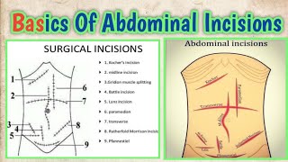 Basic Anatomy Of Abdominal Incisions l abhishekghoolibmcri [upl. by Kissel703]