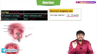 Abortion  Part  2   Obstetrics and Gynaecology Lecture [upl. by Gwen]