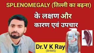 तिल्ली प्लीहा लक्षण कारण इलाज और निदान splemomegaly treatment in hindi 💯✅ [upl. by Connelly]