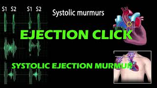 Ejection Click And Systolic Ejection Murmur pf Heart Sound [upl. by Pillow855]