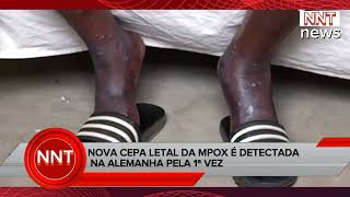 NOVA CEPA LETAL DA MPOX É DETECTADA NA ALEMANHA PELA 1° VEZ [upl. by Maribel887]