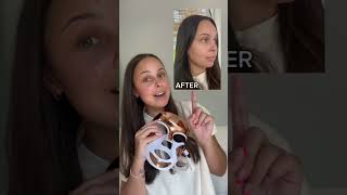 Skin transformation with LED therapy 🤩 skincareroutine clearskin skincareobsessed [upl. by Bigod]