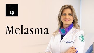 COMO TRATAR MELASMA  Laser AcromaQS® [upl. by Sivle813]