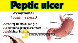 peptic ulcer risk factors symptoms diagnosis complications  treatment [upl. by Aciretehs]