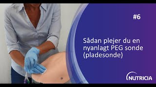 Sådan plejer du en nyanlagt PEG sonde pladesonde [upl. by Alokin]