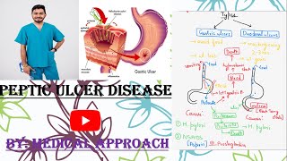 Peptic Ulcer Disease  Pathology  Medicine [upl. by Berni]