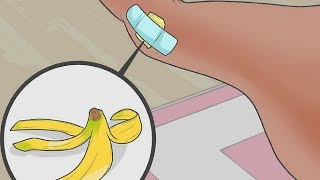 How to Painlessly Remove a SPLINTER With Banana Peel [upl. by Aina]