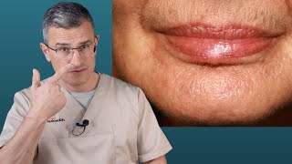 💧 Falten vorbeugen und reduzieren Diese Tipps helfen wirklich 💆‍♀️ Dr med Robert Kasten [upl. by Eirruc]