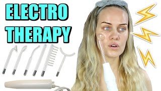 High Frequency Electrotherapy to treat ACNE [upl. by Shela119]