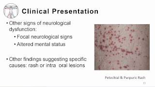 1 Overview meningitis and encephalitis [upl. by Arlyn]